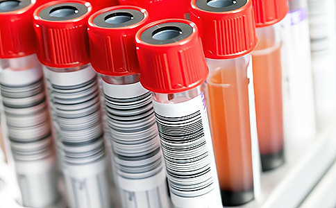 RFID���lԇ���Q�ع����쾀